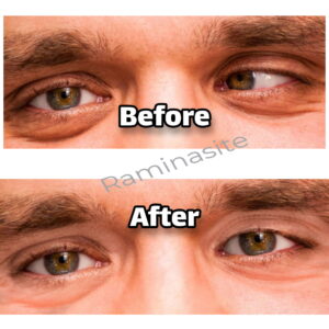 eye-retouch1