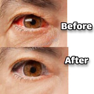 eye-retouch3