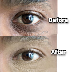 eye-retouch4